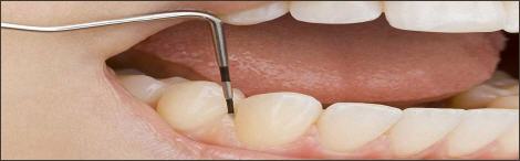 zahnarztphobie therapie oberösterreich